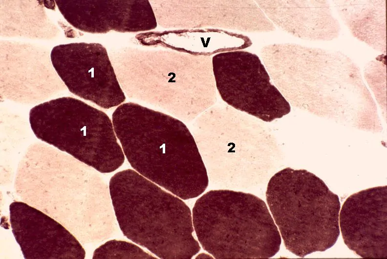 Hipertrofia, distribuição das fibras musculares