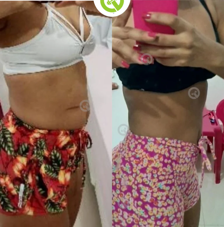 antes e depois - 2023-11-13T190035.463